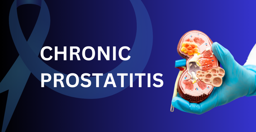 Chronic Prostatitis: Causes, Symptoms, Diagnosis, And Treatment